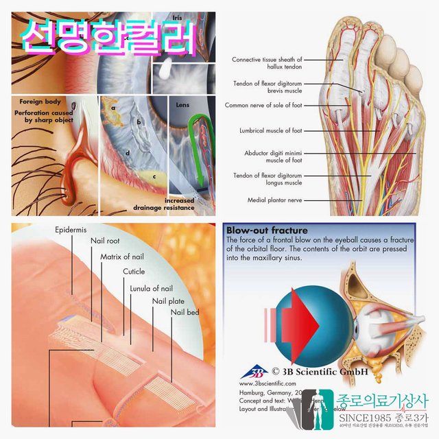 3B Scientific 손목관절 인체해부차트 VR1171 손과 손목 구조 병원액자_액자없음