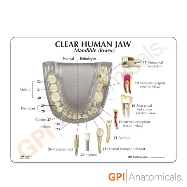 GPI USA 투명치아모형 치아 치주 질환포함 G2861 실제사이즈